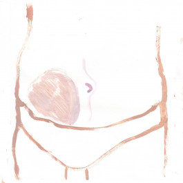 Another close up of the stomach of figure in underpants, with a large pink mass to the left of their naval 