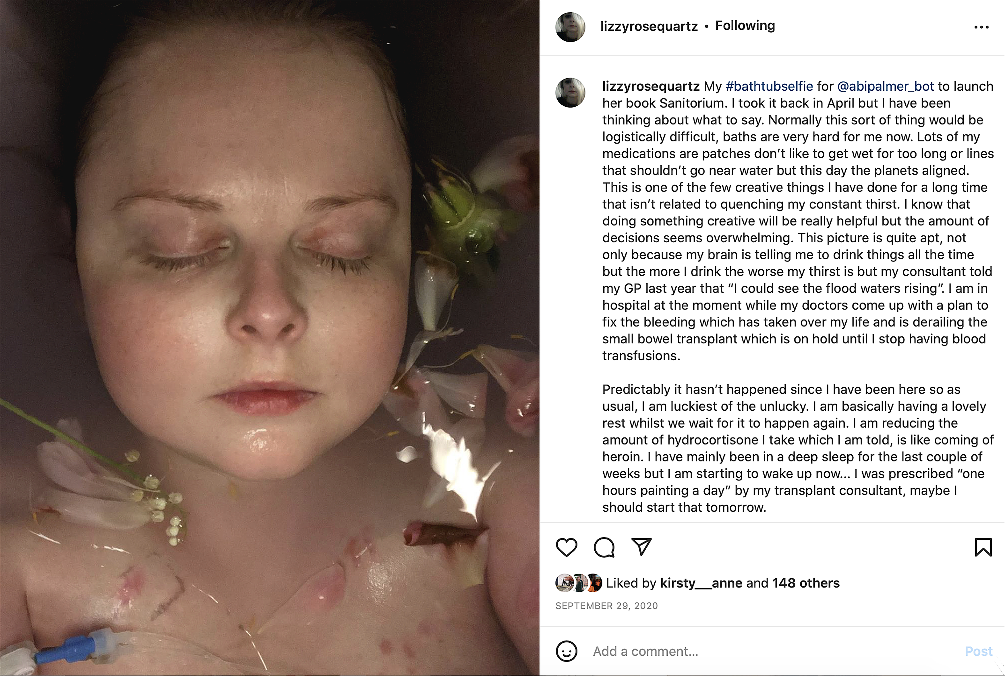 A closely cropped self portrait of Lizzy, her head and shoulders partially submerged in the bath with closed eyes. The water is mauve and full of petals. Her left arm appears to be connected to a drip. 